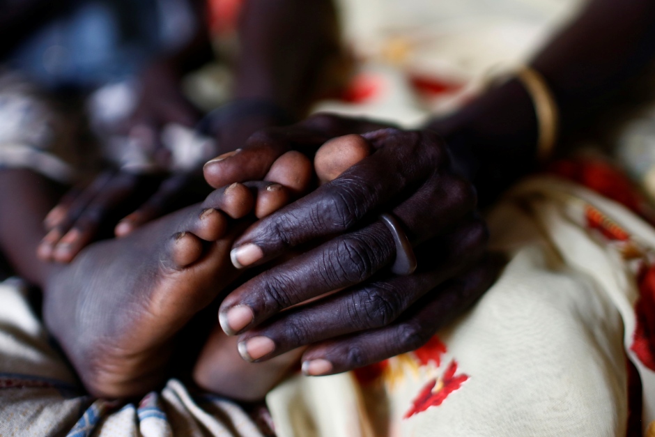 SOUTH SUDAN WAR CHILDREN hands and feet