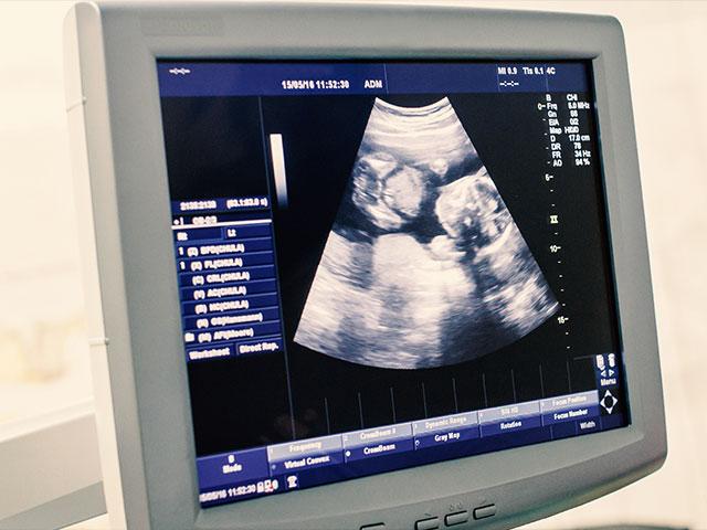 ultrasoundas_si.jpg