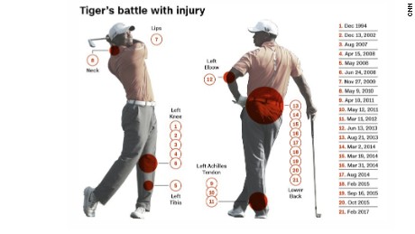 170421124054-tiger-woods-injuries-timeline-large-169.jpg